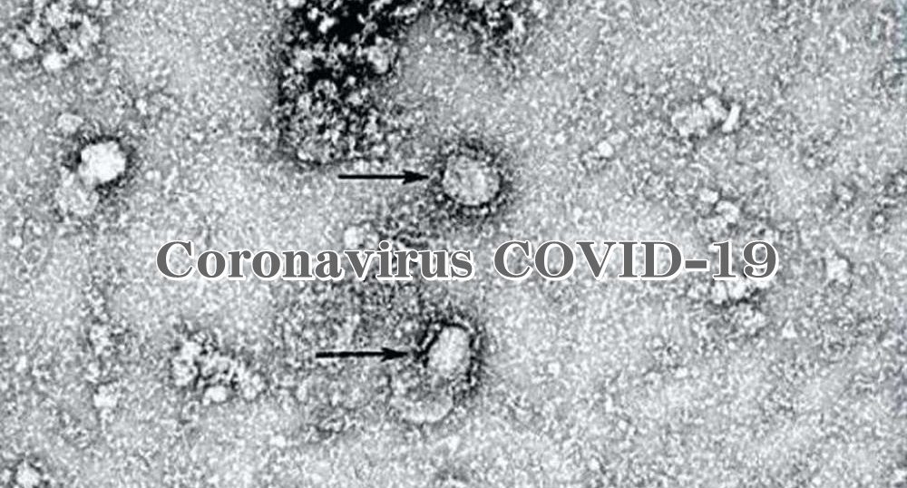 Coronavirus COVID-19